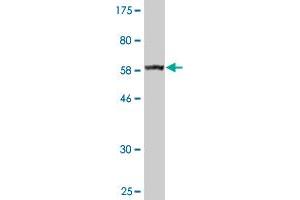 Western Blotting (WB) image for anti-3-hydroxybutyrate Dehydrogenase, Type 1 (BDH1) (AA 1-343) antibody (ABIN513700)