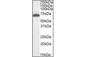 Antibody (1 µg/ml) staining of Mouse Brain lysate (35 µg protein in RIPA buffer). (GAD Antikörper  (Internal Region))