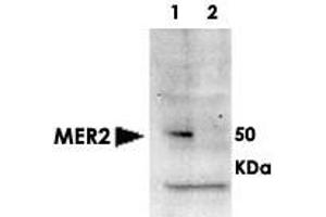 Western blot using MER2 (phospho S30) polyclonal antibody  shows detection of phosphorylated MER2 in whole cell extracts. (CD151 Antikörper  (pSer30))