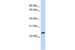WB Suggested Anti-MLX Antibody Titration: 0.
