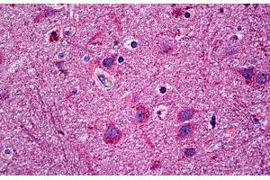 Human Brain, Cortex: Formalin-Fixed, Paraffin-Embedded (FFPE)