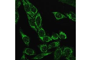 Immunofluorescence Analysis of PFA fixed HeLa cells labeling Cytochrome C Recombinant Rabbit Monoclonal Antibody (CYCS/3128R) followed by Goat anti-rabbit IgG-CF488 (Green) (Rekombinanter Cytochrome C Antikörper)