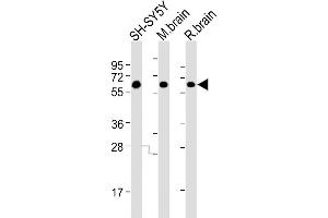 All lanes : Anti-DPYL5 Antibody at 1:4000 dilution Lane 1: SH-SY5Y whole cell lysates Lane 2: mouse brain lysates Lane 3: rat brain lysates Lysates/proteins at 20 μg per lane.