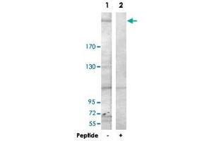 Western blot analysis of extracts from HepG2 cells, using LAMB1 polyclonal antibody .