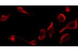 ABIN6269015 staining RAW264. (TNFRSF1B Antikörper  (C-Term))