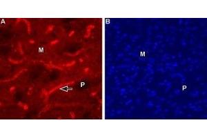 Expression of Muscarinic acetylcholine receptor M1 in mouse striatum - Immunohistochemical staining of mouse striatum using Anti-CHRM1 (443-458) Antibody (ABIN7043061, ABIN7044590 and ABIN7044591), (1:100). (CHRM1 Antikörper  (Intracellular))