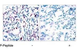Image no. 1 for anti-Signal Transducer and Activator of Transcription 3 (Acute-Phase Response Factor) (STAT3) (pTyr705) antibody (ABIN196691) (STAT3 Antikörper  (pTyr705))
