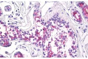 Image no. 2 for anti-Mucin 1 (MUC1) antibody (ABIN1502335) (MUC1 Antikörper)