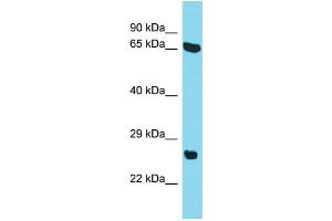 Host: Rabbit Target Name: C22orf23 Sample Type: HepG2 Whole Cell lysates Antibody Dilution: 1. (C22orf23 Antikörper  (Middle Region))
