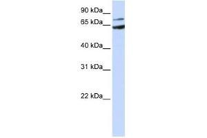 FZD8 antibody used at 1 ug/ml to detect target protein.