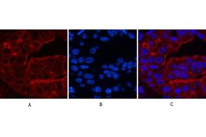 anti-ATP-Binding Cassette, Sub-Family B (MDR/TAP), Member 5 (ABCB5) antibody