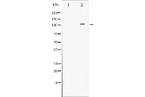 Western blot analysis of HDAC4 phosphorylation expression in CalyculinA treated Jurkat whole cell lysates,The lane on the left is treated with the antigen-specific peptide. (HDAC4 Antikörper  (pSer632))
