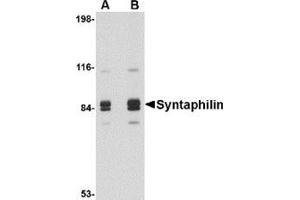 Western blot analysis of Syntaphilin in rat brain tissue lysate with this product at (A) 1 and (B) 2 μg/ml. (Syntaphilin Antikörper  (Center))