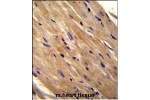 RHOJ Antibody (Center) (ABIN655708 and ABIN2845159) immunohistochemistry analysis in formalin fixed and paraffin embedded mouse heart tissue followed by peroxidase conjugation of the secondary antibody and DAB staining. (RHOJ Antikörper  (AA 131-159))