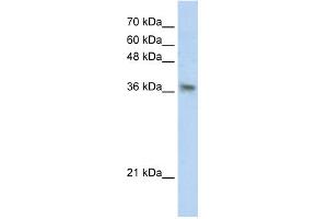 WB Suggested Anti-PHYHIP Antibody Titration:  0. (PHYHIP Antikörper  (N-Term))