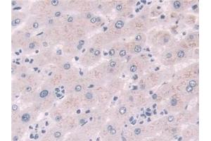 Detection of NQO1 in Human Liver Tissue using Polyclonal Antibody to NADH Dehydrogenase, Quinone 1 (NQO1) (NQO1 Antikörper  (AA 2-274))