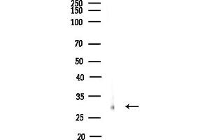 Western blot analysis of lysates from MCF7 cells(heat-shock,45 min treatment), using ARHGDIG Antibody at 1/1000 dilution.