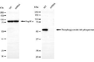 Western blotting analysis using phosphoglycerate dehydrogenase antibody (ABIN7799808). (PHGDH Antikörper)