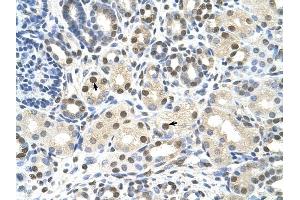 CACNB1 antibody was used for immunohistochemistry at a concentration of 4-8 ug/ml to stain Epithelial cells of renal tubule (arrows) in Human Kidney. (CACNB1 Antikörper  (Middle Region))