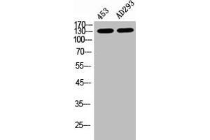 Western Blot analysis of 453 AD293 cells using Phospho-PERK (T981) Polyclonal Antibody (PERK Antikörper  (pThr981))