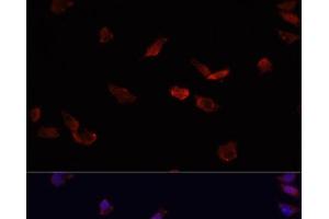 Immunofluorescence analysis of HeLa cells using BMPR2 Polyclonal Antibody at dilution of 1:100. (BMPR2 Antikörper)