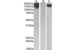 Western Blotting (WB) image for anti-Colony Stimulating Factor 1 Receptor (CSF1R) (Internal Region) antibody (ABIN2464715) (CSF1R Antikörper  (Internal Region))