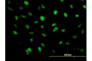 Immunofluorescence of monoclonal antibody to ZFHX1B on HeLa cell. (ZEB2 Antikörper  (AA 1115-1214))