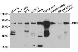 Western blot analysis of extracts of various cell lines, using GNS antibody.
