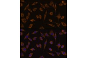 Immunofluorescence analysis of L929 cells using UGT1 Rabbit pAb (359) at dilution of 1:100 (40x lens). (UGT1A1 Antikörper  (AA 1-200))