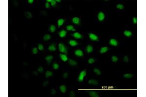 Immunofluorescence of monoclonal antibody to ALS2CR8 on HeLa cell. (Calcium Responsive Transcription Factor (CARF) (AA 621-718) Antikörper)