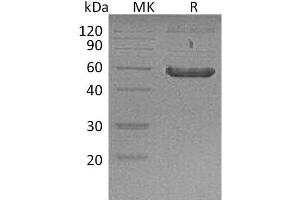 FZD2 Protein (Fc Tag)