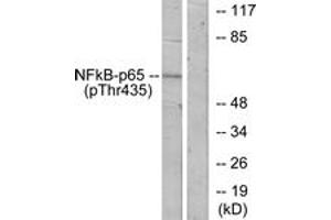 Western blot analysis of extracts from COS7 cells treated with TNF-alpha, using NF-kappaB p65 (Phospho-Thr435) Antibody. (NF-kB p65 Antikörper  (pThr435))