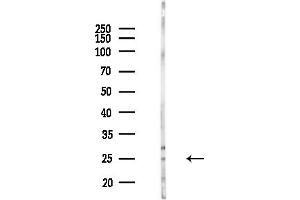 Western blot analysis of lysates from Mouse brain, using RAC2 Antibody at 1/1000 dilution.