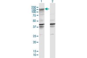 Western Blot analysis of ENPP2 expression in transfected 293T cell line by ENPP2 MaxPab polyclonal antibody. (ENPP2 Antikörper  (AA 1-863))