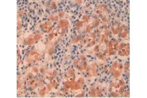Immunohistochemistry (IHC) image for anti-Cystathionase (Cystathionine gamma-Lyase) (CTH) (AA 163-382) antibody (ABIN7433750)
