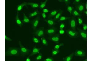 Immunofluorescence analysis of A549 cells using APTX antibody. (Aprataxin Antikörper  (AA 93-342))