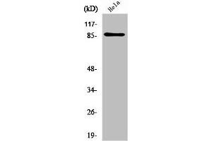 Western Blot analysis of HeLa cells using UTP14A Polyclonal Antibody (UTP14A Antikörper  (Internal Region))