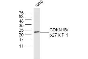 Mouse lung lysates probed with CDKN1B Polyclonal Antibody, unconjugated  at 1:300 overnight at 4°C followed by a conjugated secondary antibody at 1:10000 for 60 minutes at 37°C. (CDKN1B Antikörper  (AA 150-198))