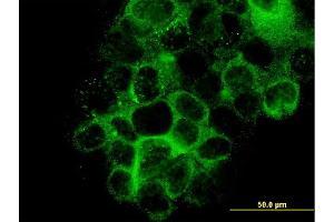 Immunofluorescence of monoclonal antibody to LAMB3 on A-431 cell. (Laminin beta 3 Antikörper  (AA 1064-1171))