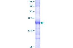 SOS1 Protein (AA 313-420) (GST tag)