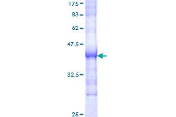 SOS1 Protein (AA 313-420) (GST tag)