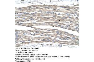 Rabbit Anti-GPR161 Antibody  Paraffin Embedded Tissue: Human Muscle Cellular Data: Skeletal muscle cells Antibody Concentration: 4. (GPR161 Antikörper  (Middle Region))