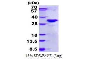 Image no. 1 for Dickkopf 2 Homolog (DKK2) protein (His tag) (ABIN6387023) (DKK2 Protein (His tag))