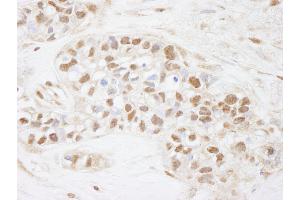 Immunohistochemistry (IHC) image for anti-Cell Division Cycle 25 Homolog C (S. Pombe) (CDC25C) (AA 150-200) antibody (ABIN7448466) (CDC25C Antikörper  (AA 150-200))