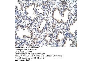 Rabbit Anti-FLJ12529 Antibody  Paraffin Embedded Tissue: Human Lung Cellular Data: Alveolar cells Antibody Concentration: 4. (CPSF7 Antikörper  (C-Term))