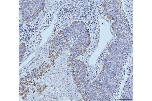 IHC analysis of ETFA using anti-ETFA antibody (ABIN7599281).