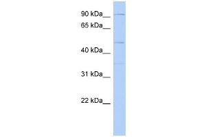 DPY19L2 antibody used at 1 ug/ml to detect target protein. (DPY19L2 Antikörper)