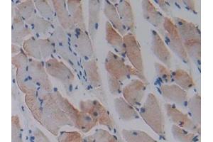 DAB staining on IHC-P; Samples: Mouse Skeletal muscle Tissue (CCL9 Antikörper  (AA 22-122))