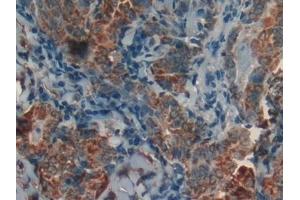 Immunohistochemistry (IHC) image for anti-Prohibitin (PHB) (AA 177-272) antibody (ABIN7431794)