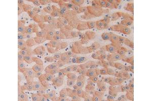 Used in DAB staining on fromalin fixed paraffin- embedded liver tissue (CD39 Antikörper  (AA 241-486))